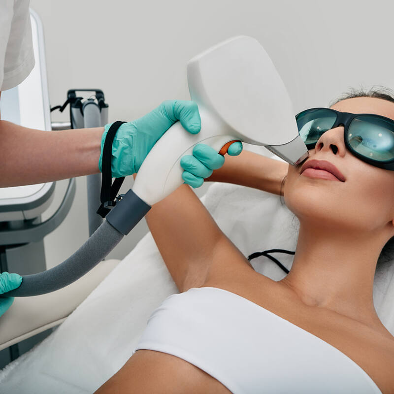Brunette woman getting laser hair removal on her face, laser epilation to lips area. Facial laser hair removal